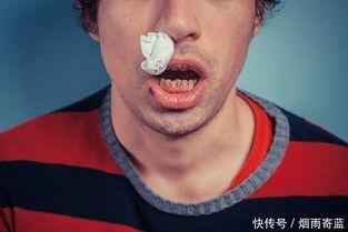 韩婧格 吃瓜 流鼻血,瓜田李下，明星生活也难料